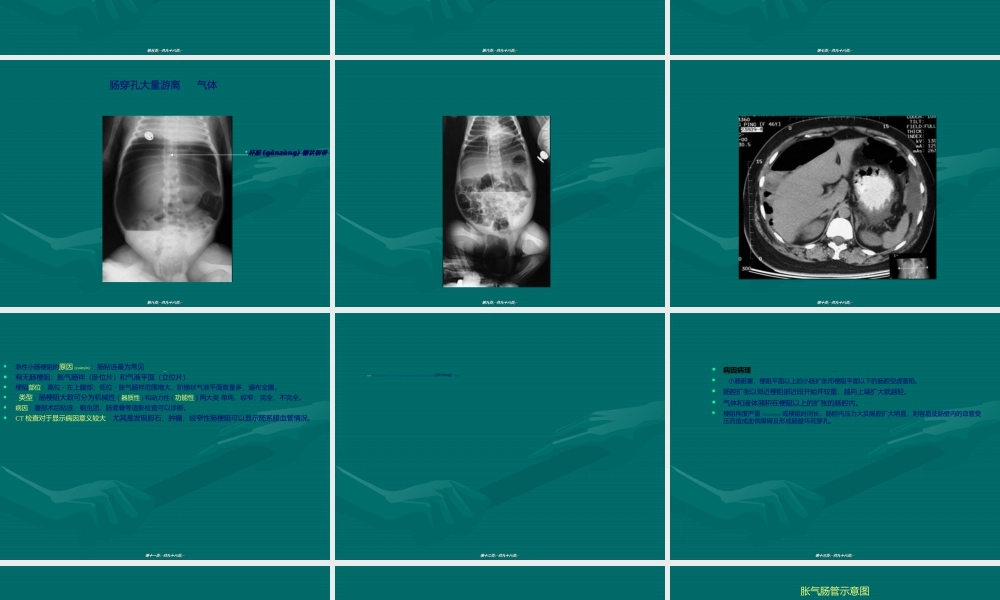 2022年医学专题—急腹症腹膜后疾患.ppt