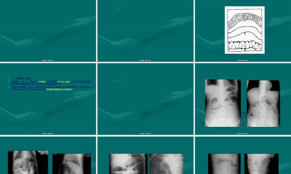 2022年医学专题—急腹症腹膜后疾患.ppt