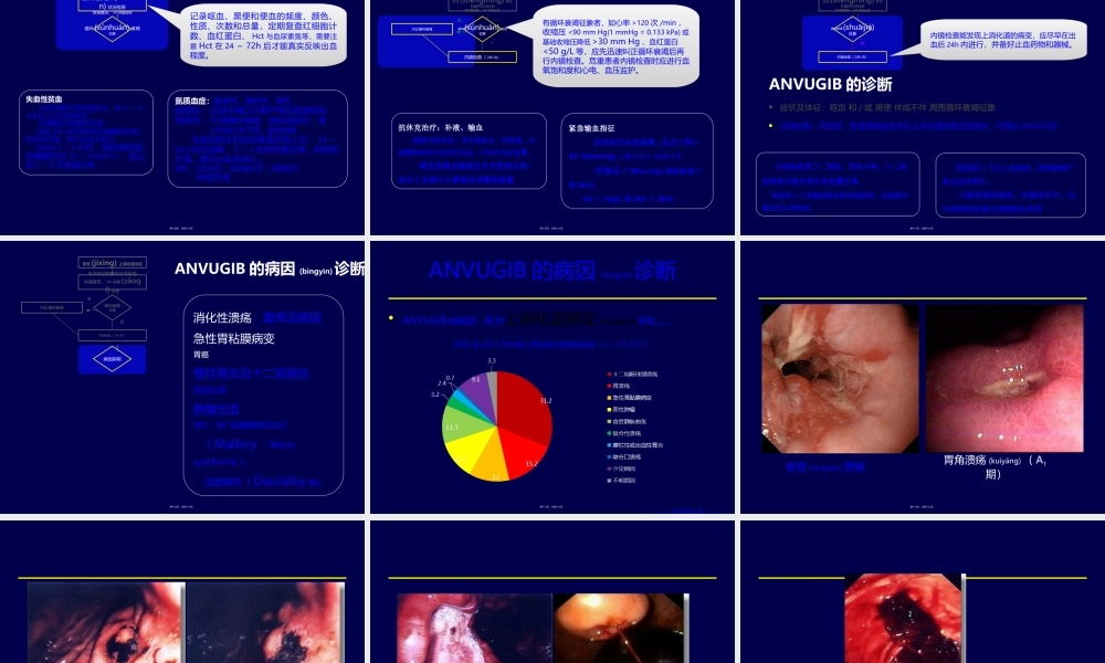 2022年医学专题—急性非静脉曲张性上消化道出血的规范化诊疗-王春峰.ppt