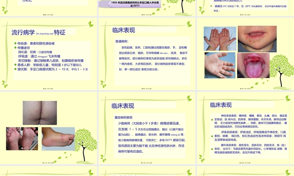 2022年医学专题—手足口病防治.pptx