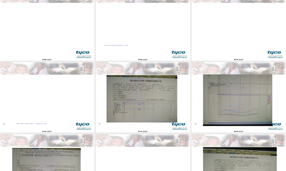 2022年医学专题—术后认知功能障碍.ppt