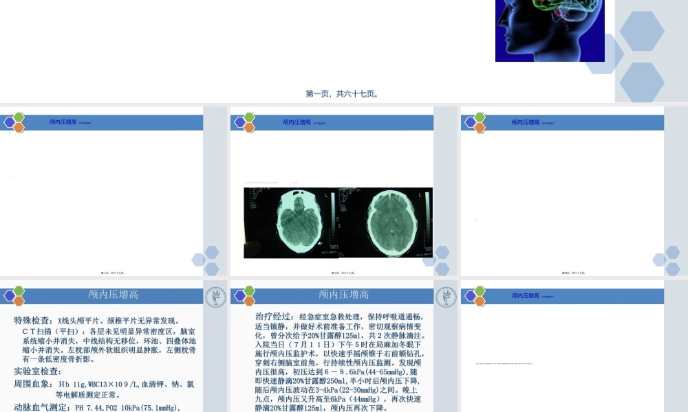 2022年医学专题—最新新版颅内压增高病例PPT-PPT文档.ppt