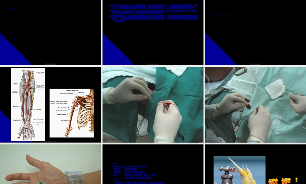 2022年医学专题—桡动脉穿刺技巧.ppt