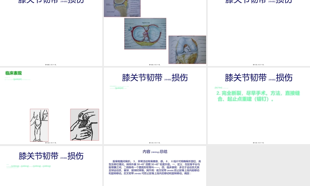 2022年医学专题—浅析骨折各论(4).ppt