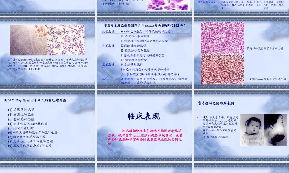 2022年医学专题—淋巴瘤.ppt