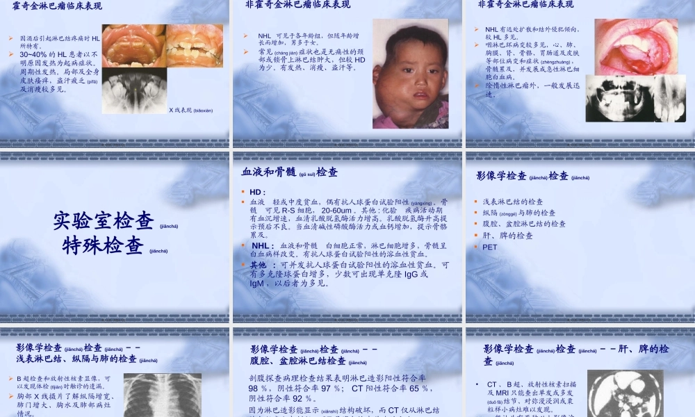 2022年医学专题—淋巴瘤.ppt