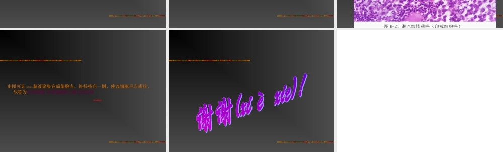 2022年医学专题—淋巴结转移癌教学大纲.ppt