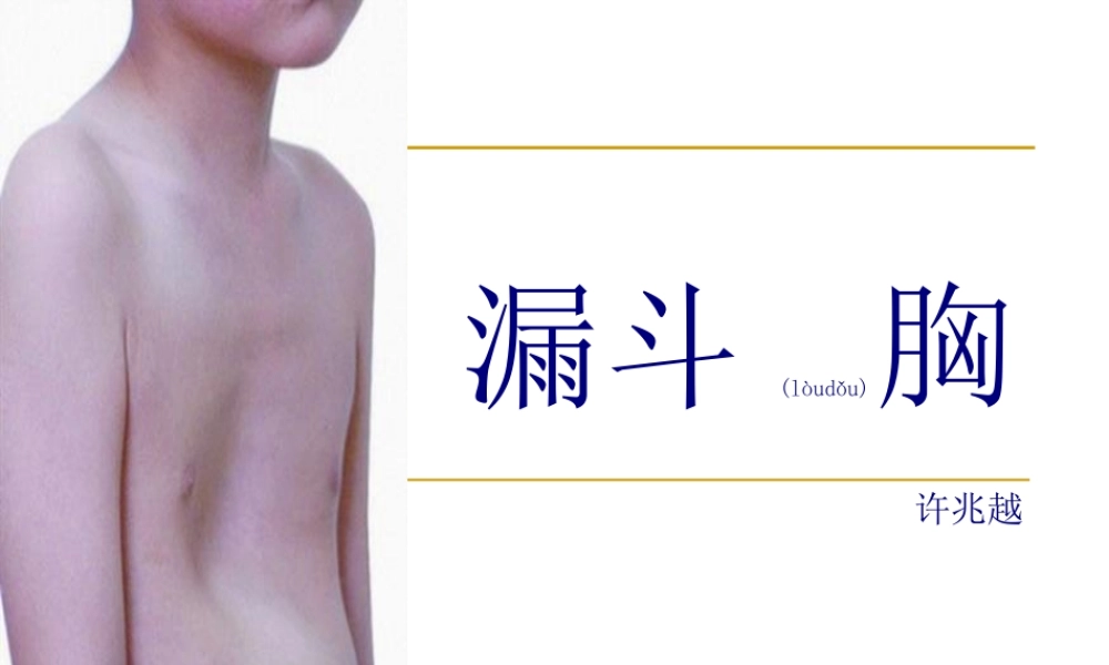 2022年医学专题—漏斗胸-ppt.ppt