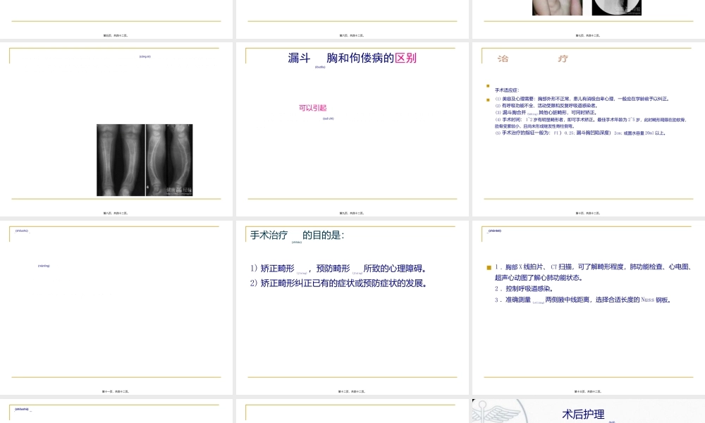 2022年医学专题—漏斗胸-ppt.ppt