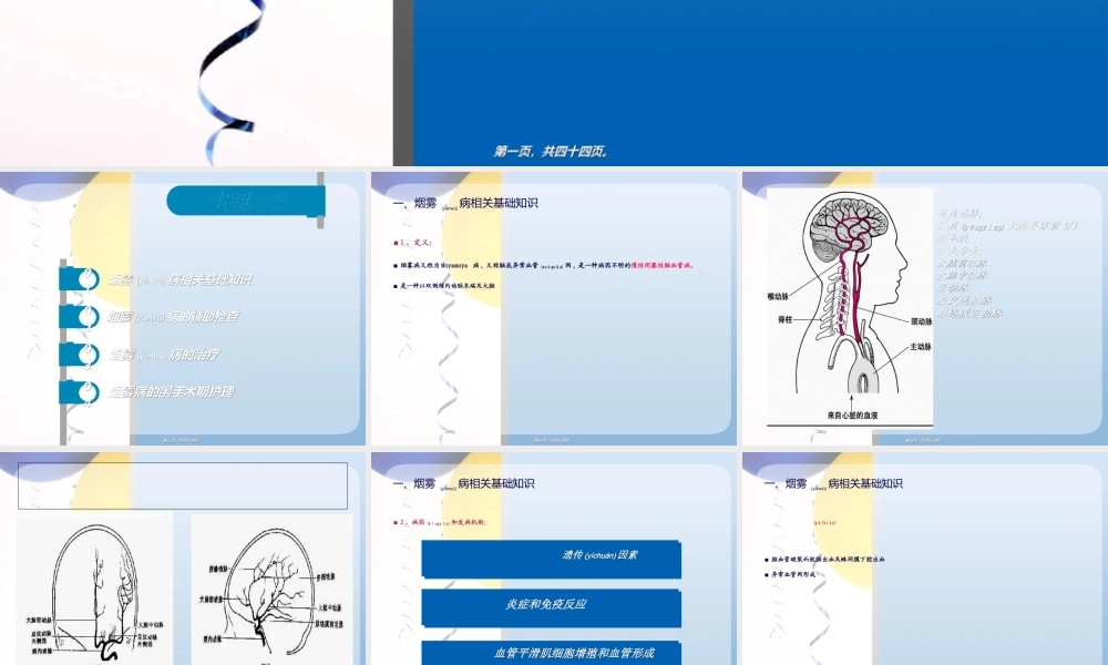 2022年医学专题—烟雾病.ppt