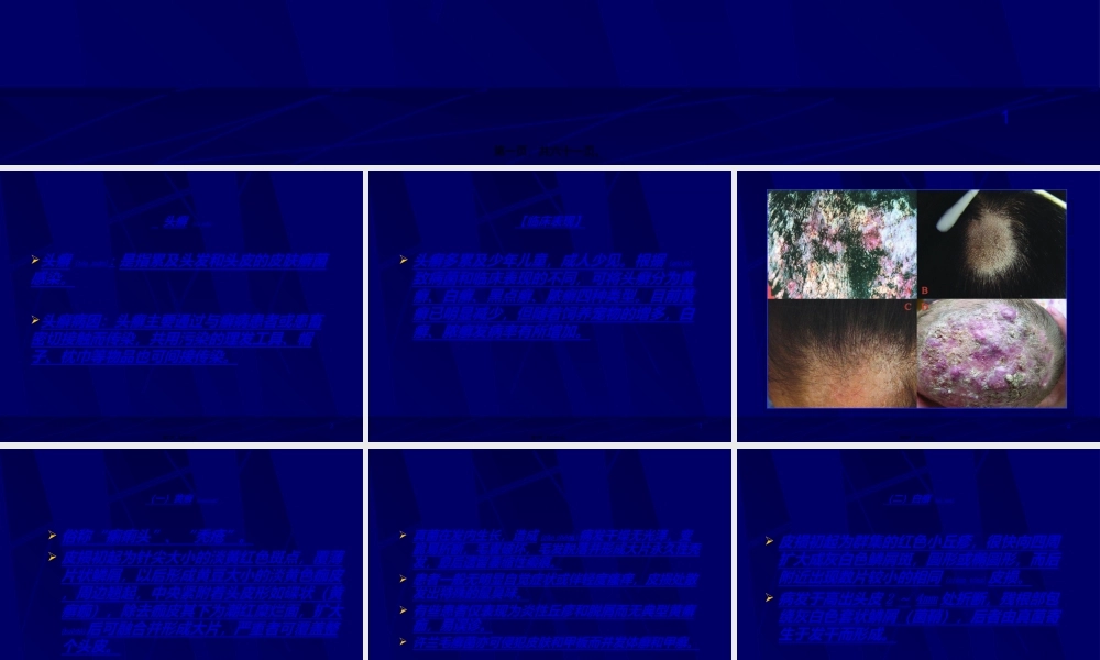 2022年医学专题—真菌性皮肤病分析.ppt