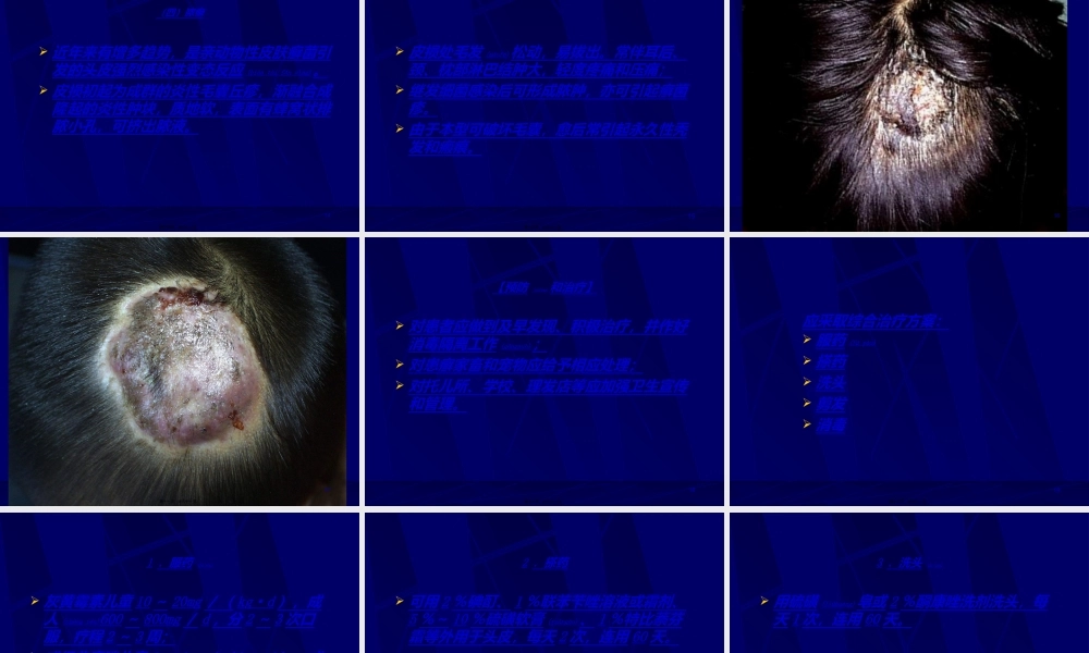 2022年医学专题—真菌性皮肤病分析.ppt