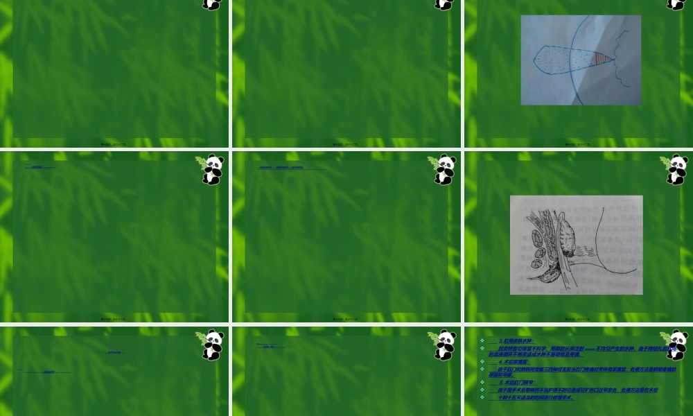 2022年医学专题—痔结扎注射术--二龙路医院--董平教授.ppt