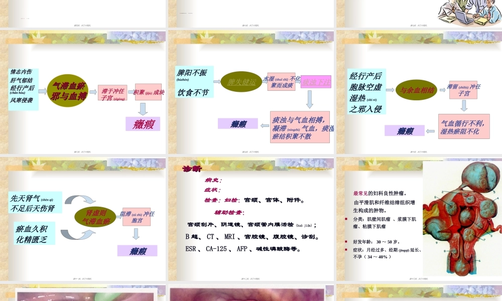 2022年医学专题—症-瘕.ppt