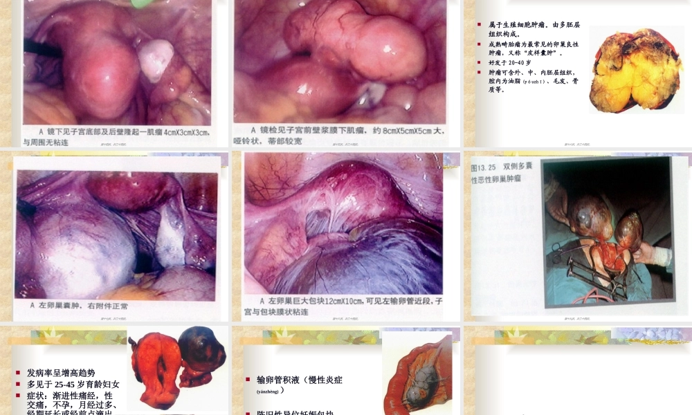 2022年医学专题—症-瘕.ppt