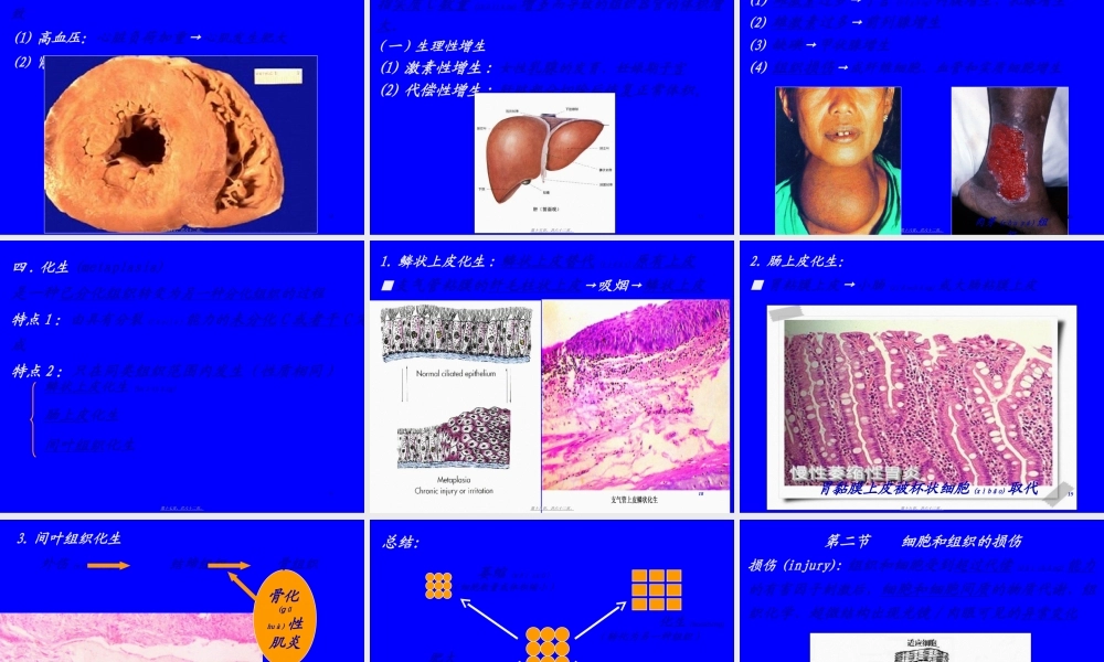2022年医学专题—第2章-细胞和组织的适应与损伤(1).ppt