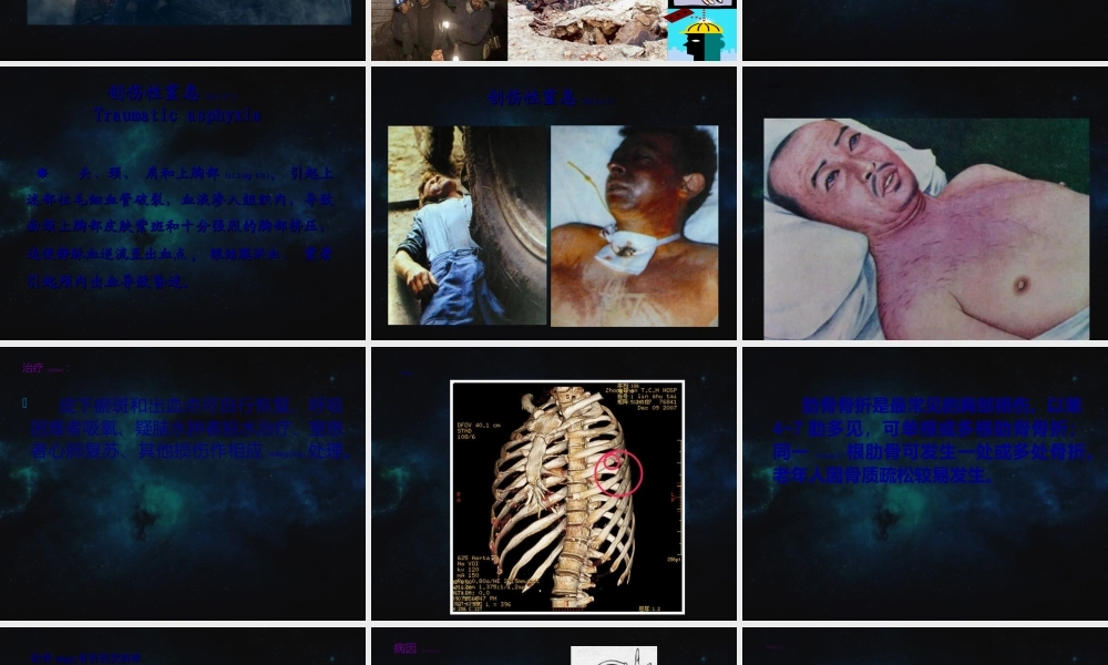 2022年医学专题—第二十一章-胸部损伤-(1)(1).ppt