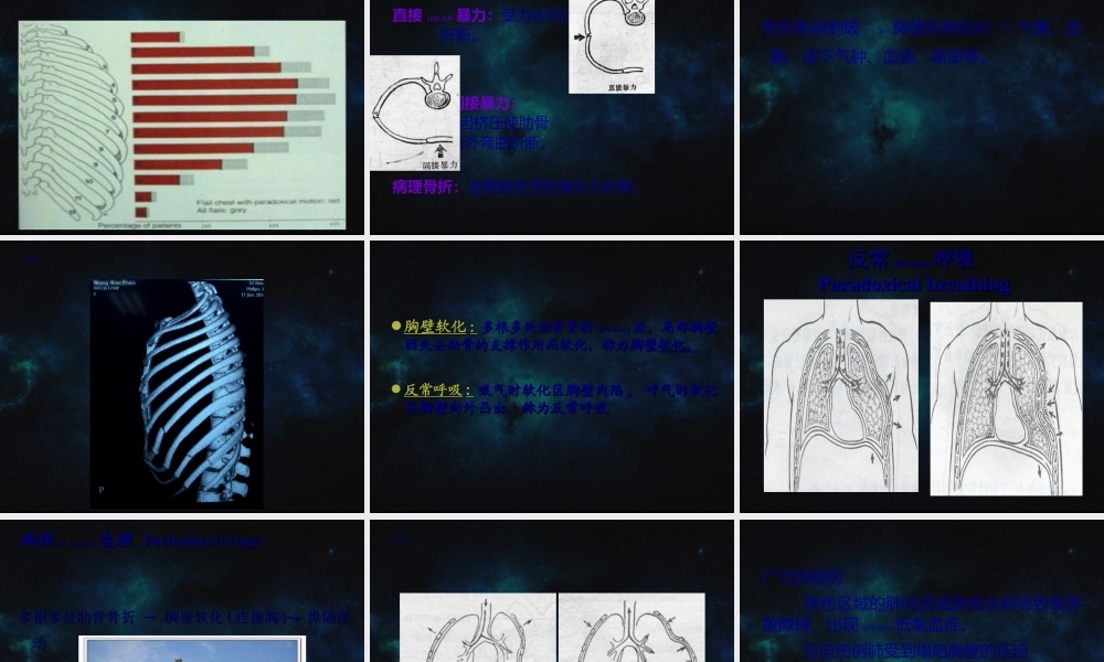 2022年医学专题—第二十一章-胸部损伤-(1)(1).ppt