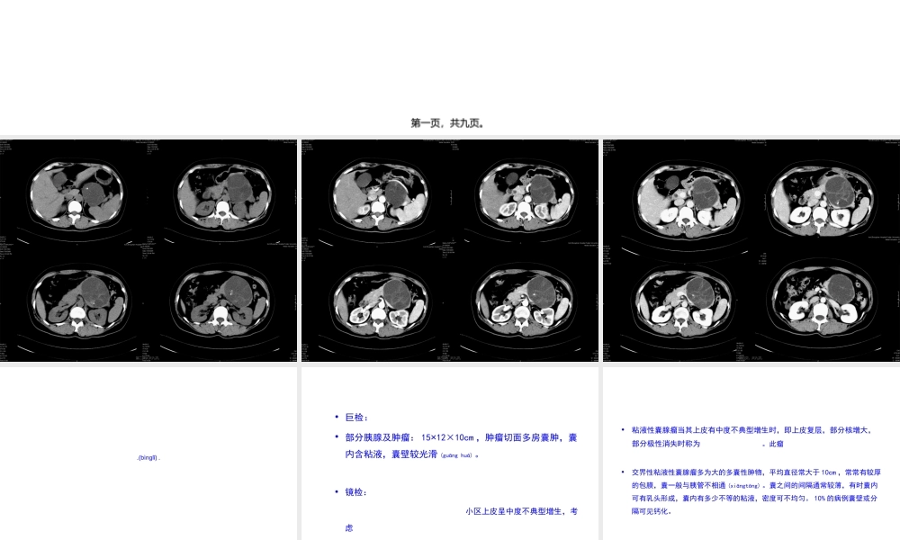 2022年医学专题—粘液性囊腺瘤讲座.ppt