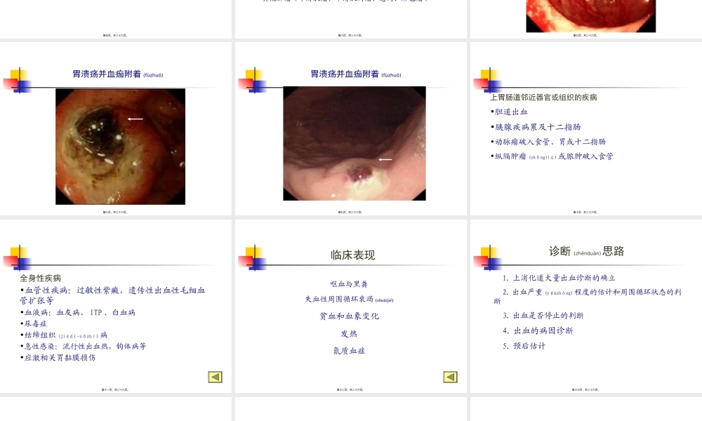 2022年医学专题—第四篇-第十九章-上消化道出血诊疗常规.ppt