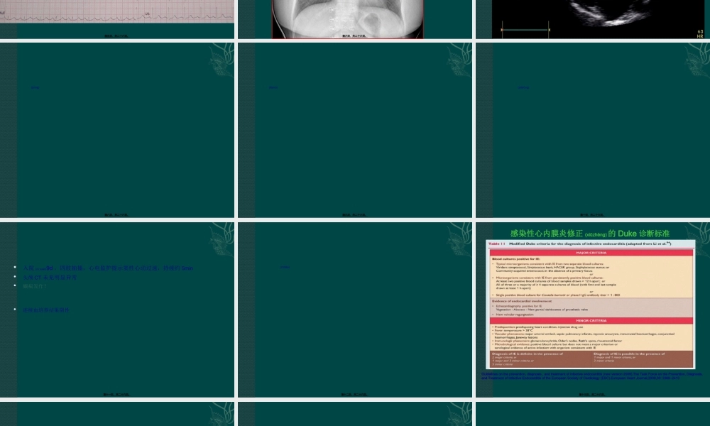 2022年医学专题—系统性红斑狼疮误诊为感染性心内膜炎1例.ppt