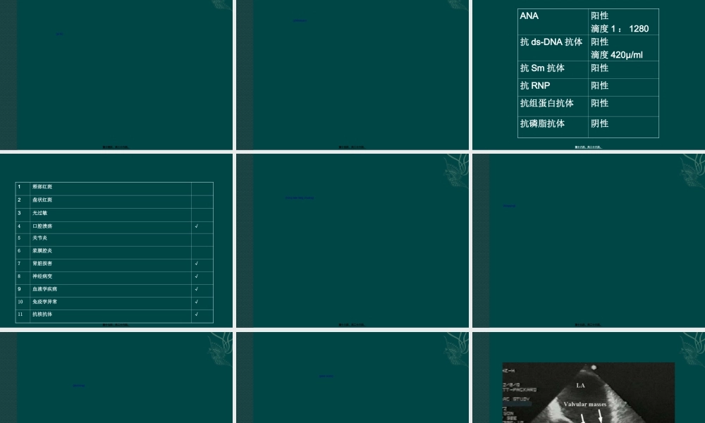 2022年医学专题—系统性红斑狼疮误诊为感染性心内膜炎1例.ppt