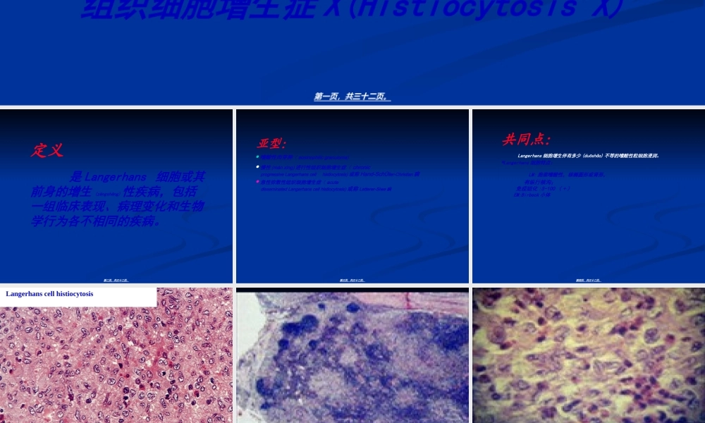 2022年医学专题—组织细胞增生症X.ppt