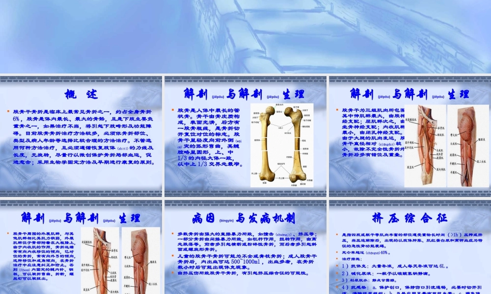 2022年医学专题—股骨干骨折.ppt