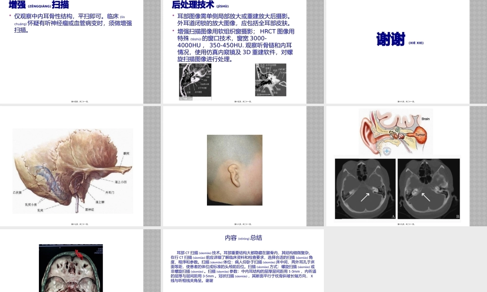 2022年医学专题—耳部CT扫描技术.pptx