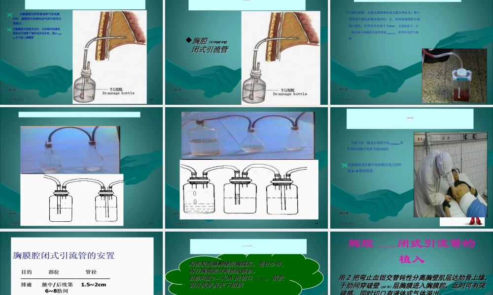 2022年医学专题—胸腔引流查房.ppt
