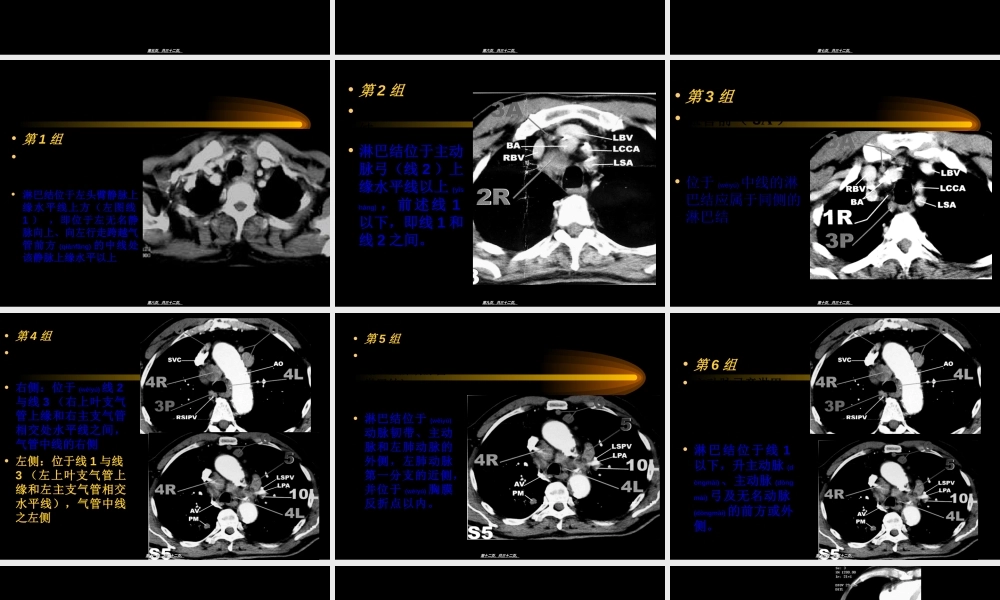 2022年医学专题—胸部CT纵隔淋巴结分区-(1).ppt