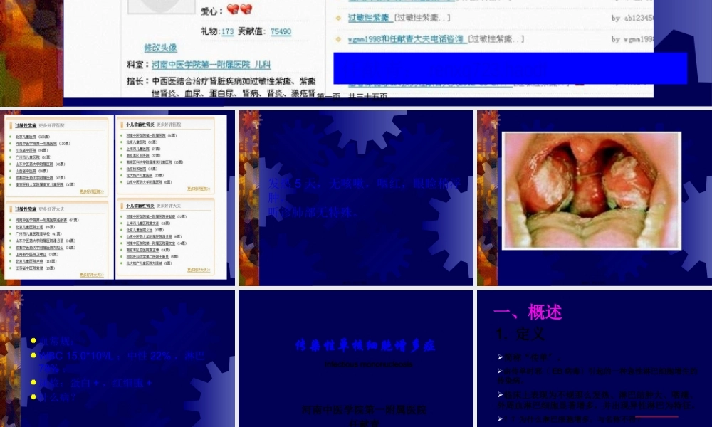 传染性单核细胞增多症2012级.pptx