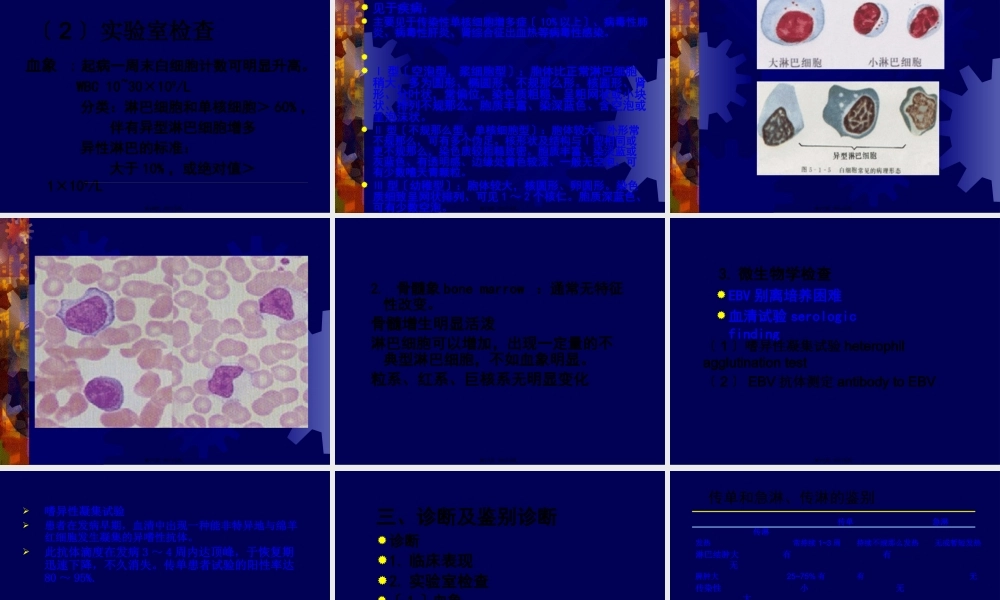 传染性单核细胞增多症2012级.pptx