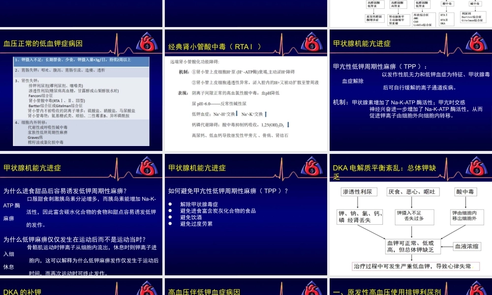 低钾血症.pptx