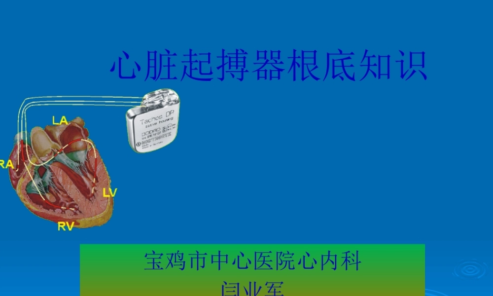 人工心脏起搏器.pptx