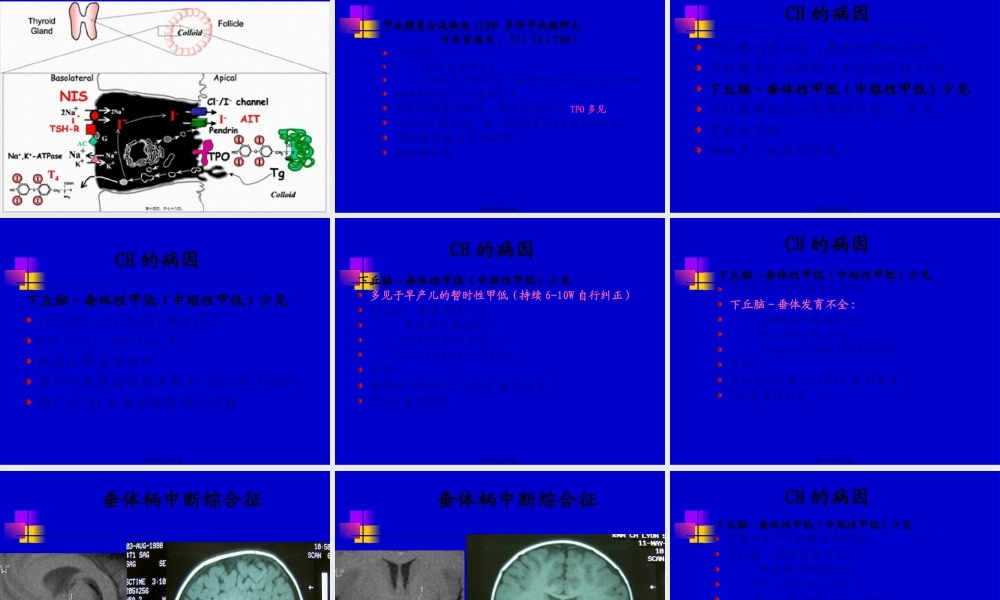 儿童甲低和甲亢(yjs).pptx