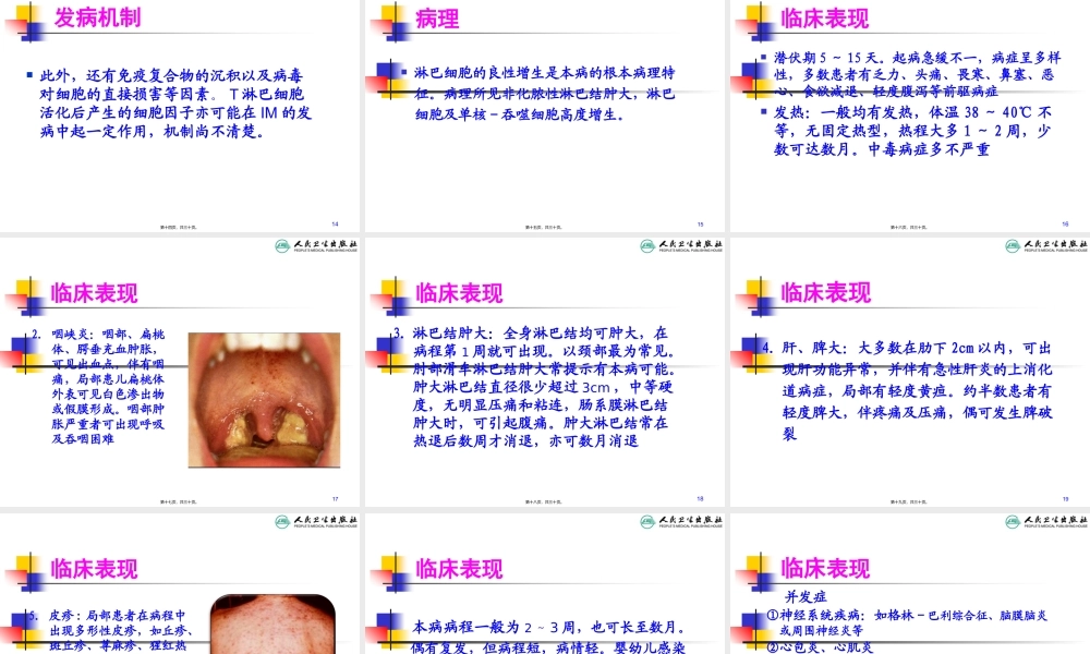 传染性单核细胞增多症-(1).pptx