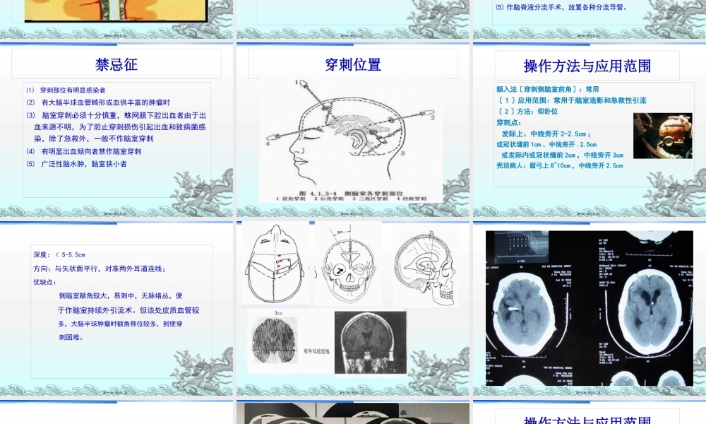 侧脑室穿刺术及脑脊液引流.pptx