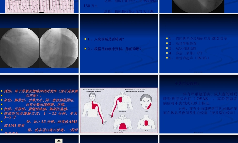 冠心病诊治的常见误区.pptx