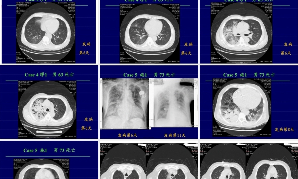 人感染H7N9禽流感知识.pptx