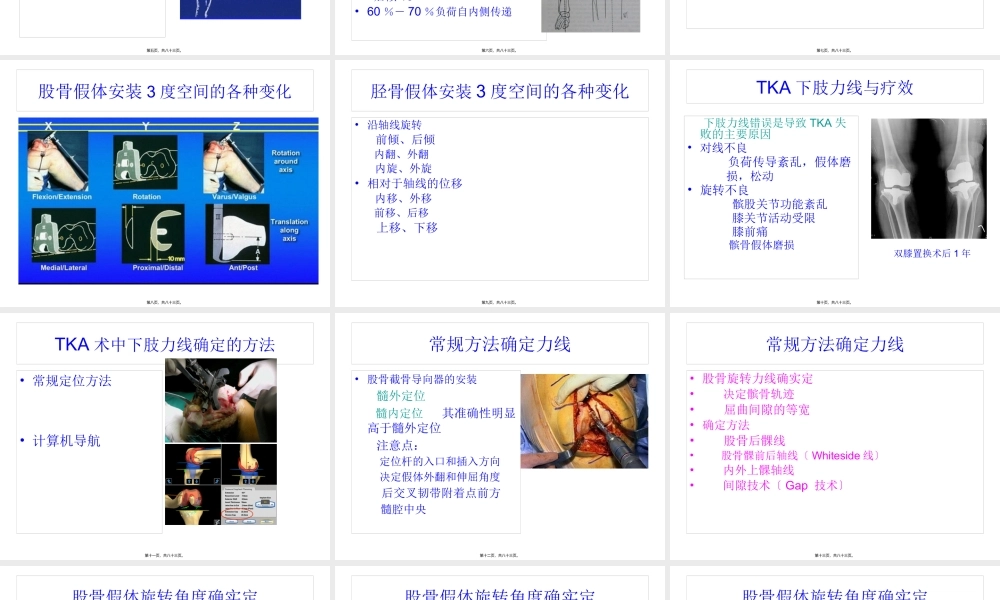 全膝关节置换术力线.pptx