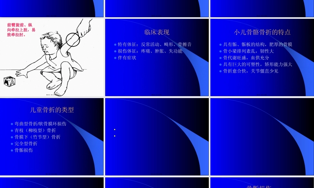 儿童常见骨折及处理.pptx
