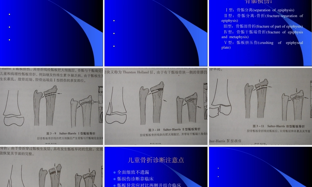 儿童常见骨折及处理.pptx