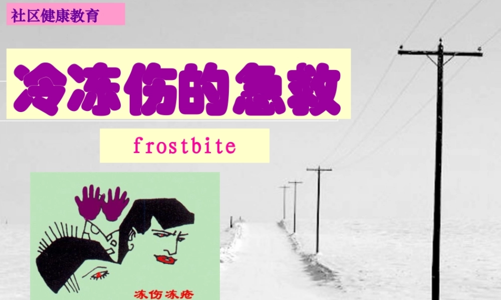 冻伤的急救.pptx
