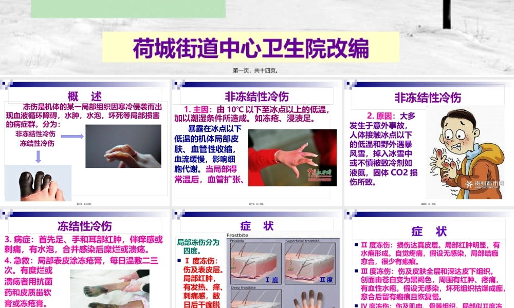 冻伤的急救.pptx