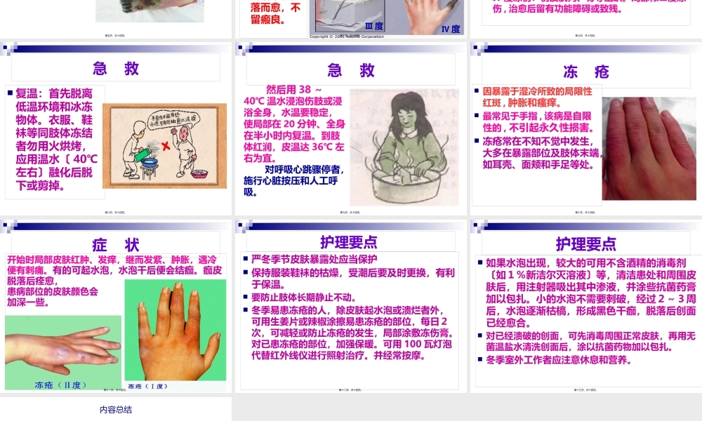 冻伤的急救.pptx