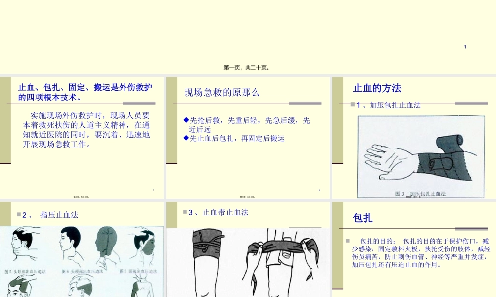 外伤急救四项基本知识..pptx