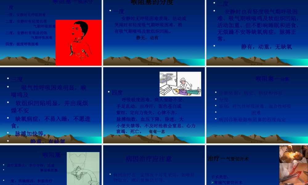 喉梗阻及气管切开.pptx
