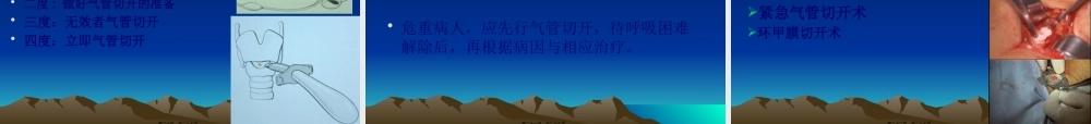 喉梗阻及气管切开.pptx
