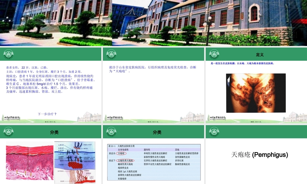 大疱性皮肤病1.pptx